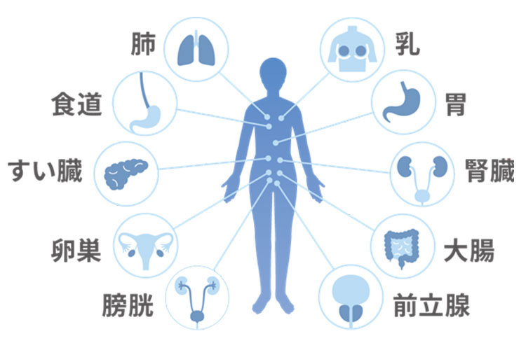 マイシグナル（尿がん検査）画像2